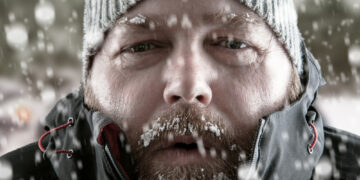 Why and how does hypothermia help people survive in some situations?